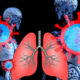 COVID-19: How It Affects Your Lungs?